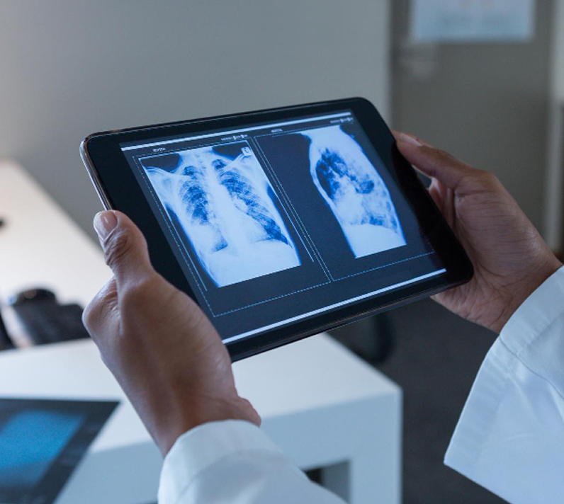 Clinician reviewing a medical scan on a tablet